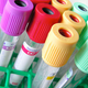 Image for article titled The Shocking Numbers On Untested Rape Kits